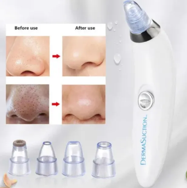 Derma Suction Pore Cleaning Device- AG00005978 - Image 5